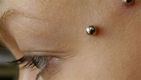 Piercing Rejection: Signs, Prevention, Treatment, Pictures